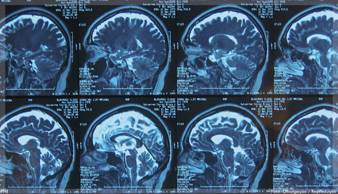 Luz poderá recuperar pacientes com traumatismo cranioencefálico grave