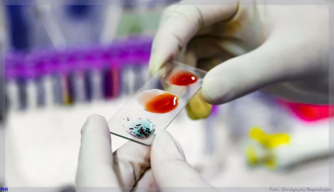 Cientistas convertem sangue tipo A em doador universal com a ajuda de enzimas bacterianas