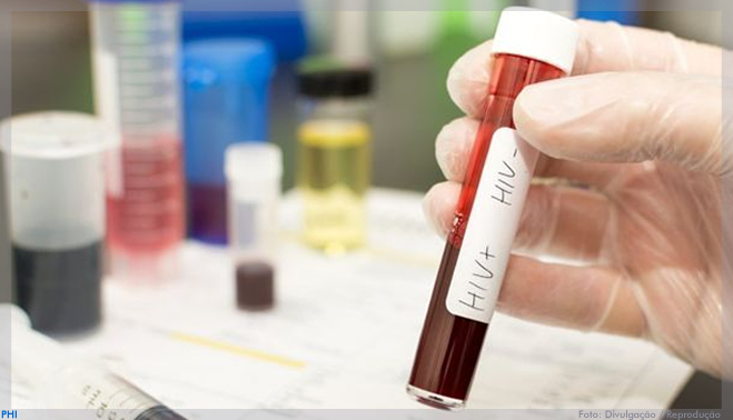 Vírus HIV é removido pela primeira vez do genoma de animais vivos