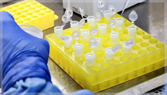 Anvisa aprova teste de anticorpos contra coronavírus criado pela Roche