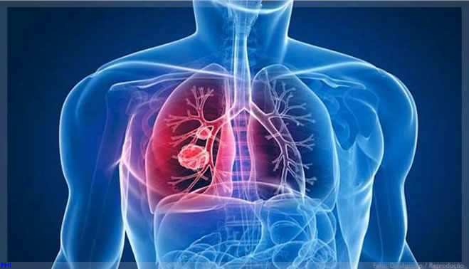 Novas moléculas inibem enzima importante para a bactéria da tuberculose
