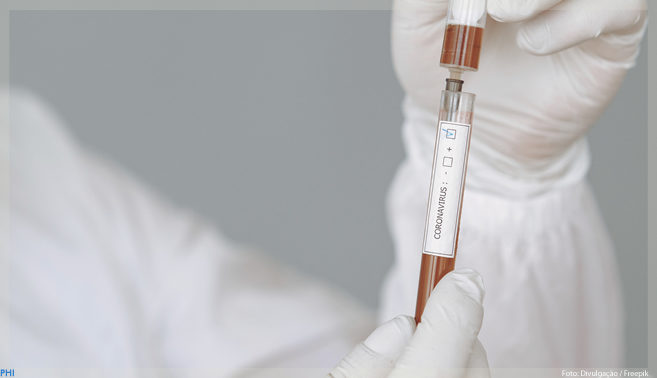 Descoberta proteína que pode indicar nível de gravidade da COVID-19 no organismo
