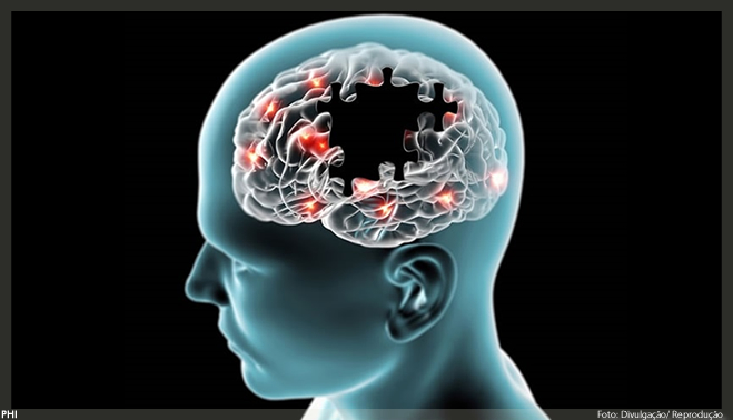 Doença de Alzheimer: como a medicina de precisão poderia reverter o declínio cognitivo