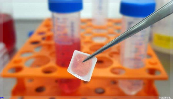 Biocurativo de células-tronco permite o tratamento inteligente de feridas e queimaduras