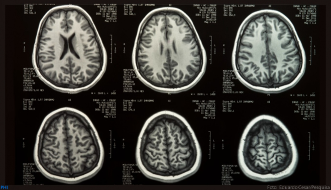 Cientistas criam ferramenta de referência para o desenvolvimento cerebral